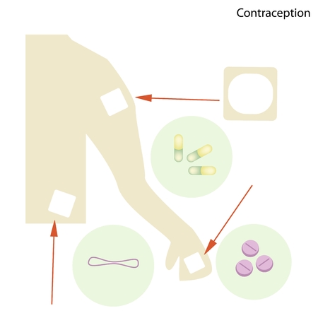 Illustration of Contraceptive Pills Condom and Contraception Patch for Contraception and Birth Control.のイラスト素材