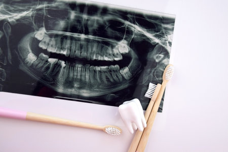 Panoramic snapshot of the jaw the patient's tooth on a light blue background.