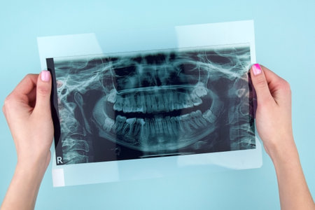 A dentist holding a snapshot of the patient's tooth. Panoramic shot of the jaw on a light blue background.の写真素材