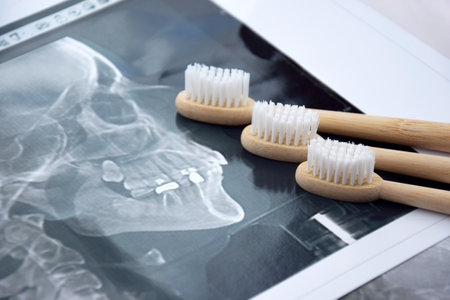 Panoramic snapshot of the jaw the patient's tooth on a light blue background.の写真素材