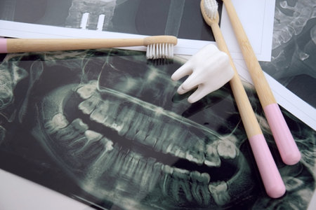 Panoramic snapshot of the jaw the patient's tooth on a light blue background.