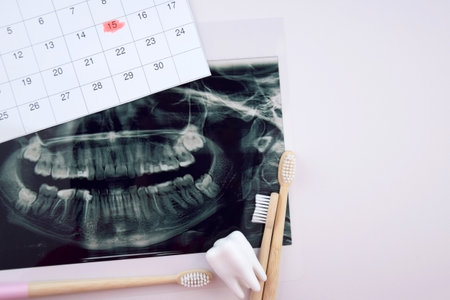 Panoramic snapshot of the jaw the patient's tooth on a light blue background.の写真素材
