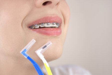 Portrait of a young girl with braces. bit alignment. Working on a beautiful smile. Orthodontics,...