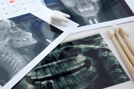 Panoramic snapshot of the jaw the patient's tooth on a light blue background.の写真素材