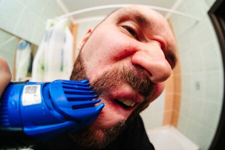 Portrait of handsome naked man getting hurt while shaving with a razor
