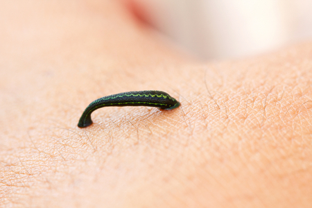 Tropical land leech (Haemadipsa crenata) sucking some blood from the skin. Haemadipsa crenata
