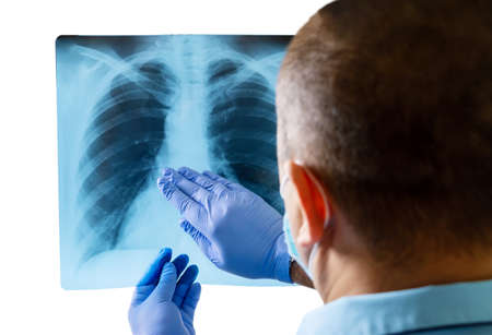 Male doctor in lab coat, medical gloves and mask reading and analyzing issue in lungs of patient...