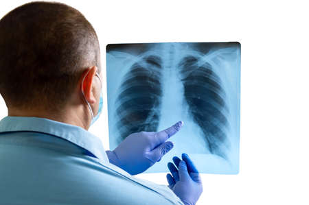 Doctor examining x-ray of chest and ribs and indicates health problems. Isolated mockup on white...