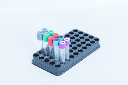 tubes of blood  for Health care in hospitalの写真素材