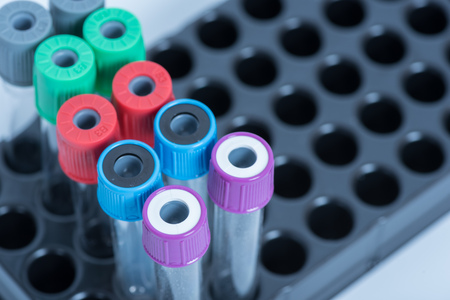 tubes of blood  for Health care in hospitalの写真素材