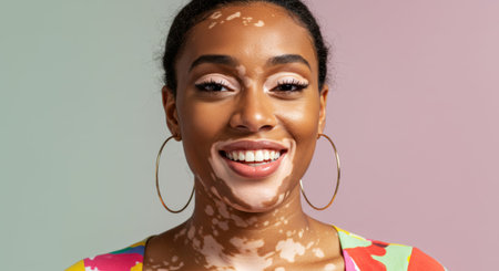 Confident young woman with vitiligo smiling against colorful background.の素材