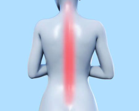3d render illustration of female figure standing with infammated spine area on blue background.