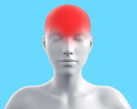 3d render artwork illustration of female gray colored figure with head pain on blue background.の写真素材