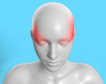 3d render artwork illustration of female gray colored figure with migraine pain on blue background.の写真素材
