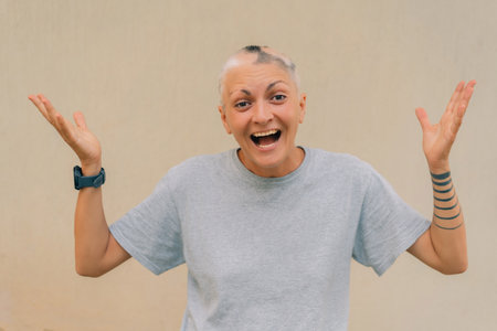 Real alopecia areata in a young girl. A bald head in a person. Diffuse alopecia. Androgenic alopecia. Hair loss. Bald spots on the head. Trichology. High quality photoの写真素材