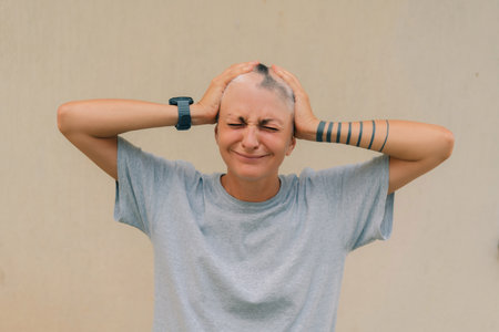 Real alopecia areata in a young girl. A bald head in a person. Diffuse alopecia. Androgenic...