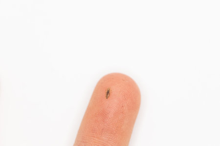 A human louse on a finger when lice was discovered in a child's hair