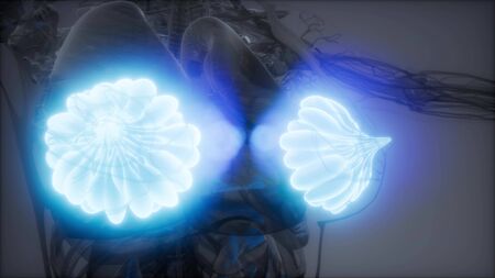 3d rendered medically accurate illustration of an obese womens mammary glands