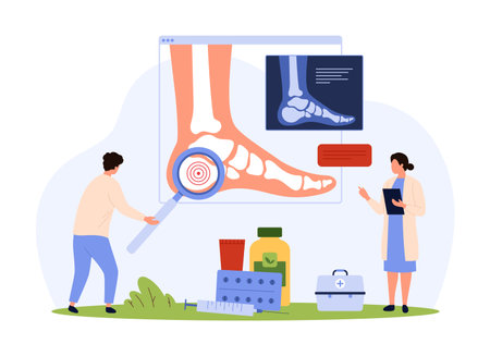 Rheumatoid arthritis, osteoarthritis, rheumatism diagnosis and treatment, rheumatology vector illustration. Cartoon tiny people research xray of patients foot with magnifying glass in hospitalのイラスト素材