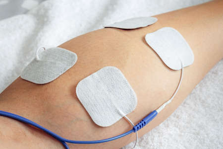 Electro-stimulation session of the twin with patchesの写真素材