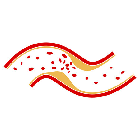 vector of cholesterol plaque illustratrion designのイラスト素材