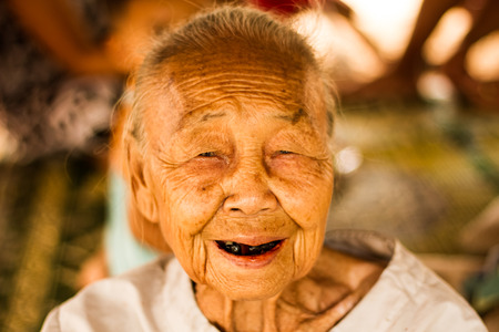 Senior asian woman smiling with black teethà¹の写真素材