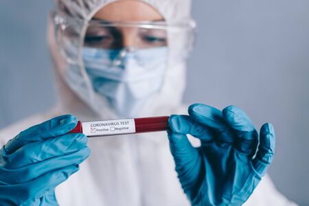 Coronavirus testing. A nurse holds in her hand a test tube with a blood sample with a positive result. Close-up. Selective focus.の写真素材