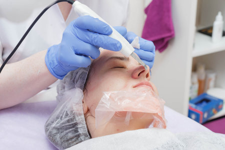 woman getting ultrasound skin cleaning at beauty salon