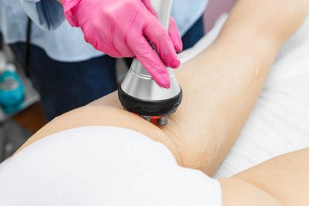 The doctor does the Rf lifting procedure on the legs, buttocks and hips of a woman in a beauty...