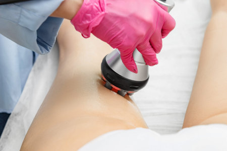 The doctor does the Rf lifting procedure on the legs, buttocks and hips of a woman in a beauty...