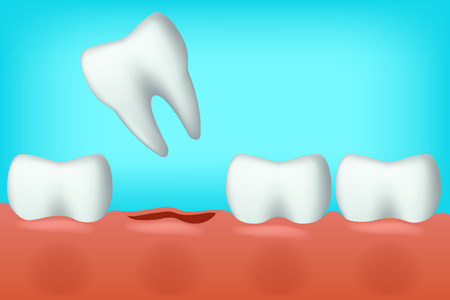 illustration of white teeth on blue background one fellのイラスト素材