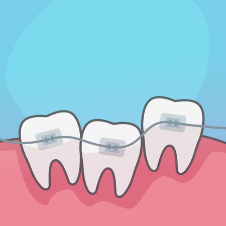a dental braces fixing teeth flat designのイラスト素材