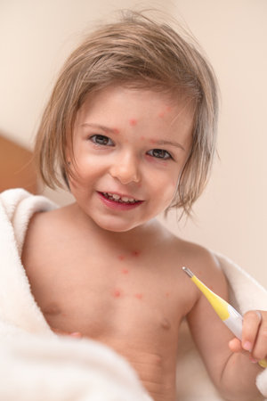 Child with chicken pox sitting with Thermometeの写真素材