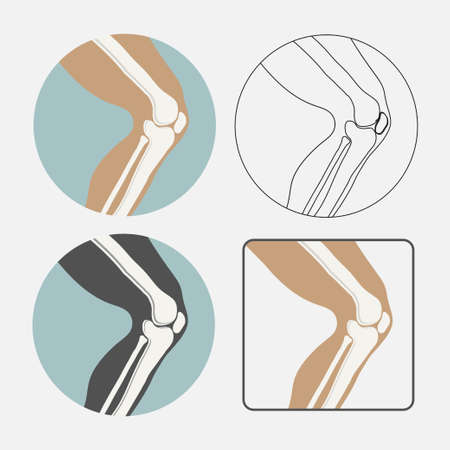 Human knee joint icon set, logo for orthopedic clinic, flat stylのイラスト素材