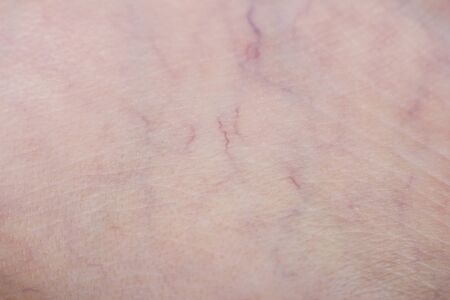 Human skin with wounds and without wounds close