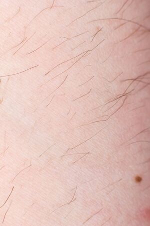 Human skin with wounds and without wounds closeの写真素材