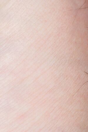 Human skin with wounds and without wounds closeの写真素材