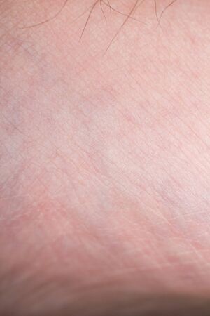 Human skin with wounds and without wounds closeの写真素材