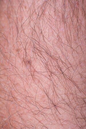 Human skin with wounds and without wounds closeの写真素材