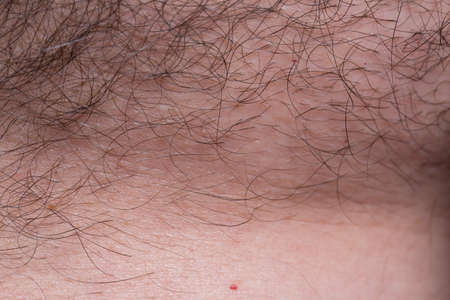 Long hair on human skin, skin with hair closeの写真素材