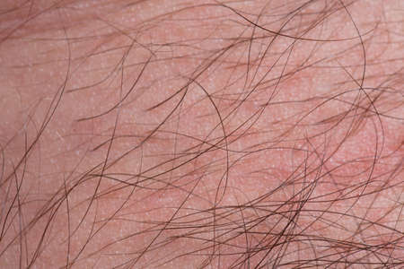Long hair on human skin, skin with hair closeの写真素材