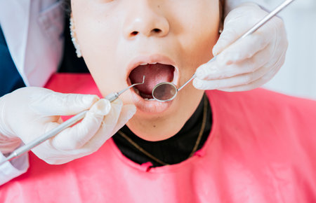 Dentist checking patient mouth with dental mirror. Close-up of patient checked by dentist, close-up of dentist's hands checking patient's mouth, dentist performing stomatologyの写真素材