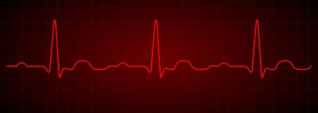 Heartbeat line. Red electrocardiogram. Medical cardiogram on grid background.のイラスト素材