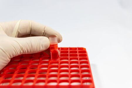 Doctor failure sample in deep freezer storage container