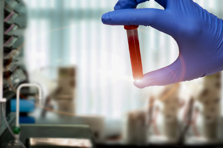 Diagnostician scientist  red reactive into tube,  syringe and tubes in hand holding in hand for lab testing resultedの写真素材