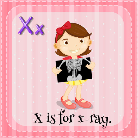 Illustration of a letter X is for x-rayのイラスト素材