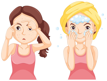 Woman washing face and woman with pimples illustrationのイラスト素材