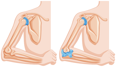 Diagram showing elbow joints illustrationのイラスト素材