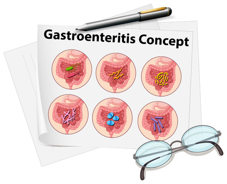 Gastroenteritis concept on paper illustrationのイラスト素材