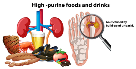 High-Purine Foods and Drinks illustrationのイラスト素材